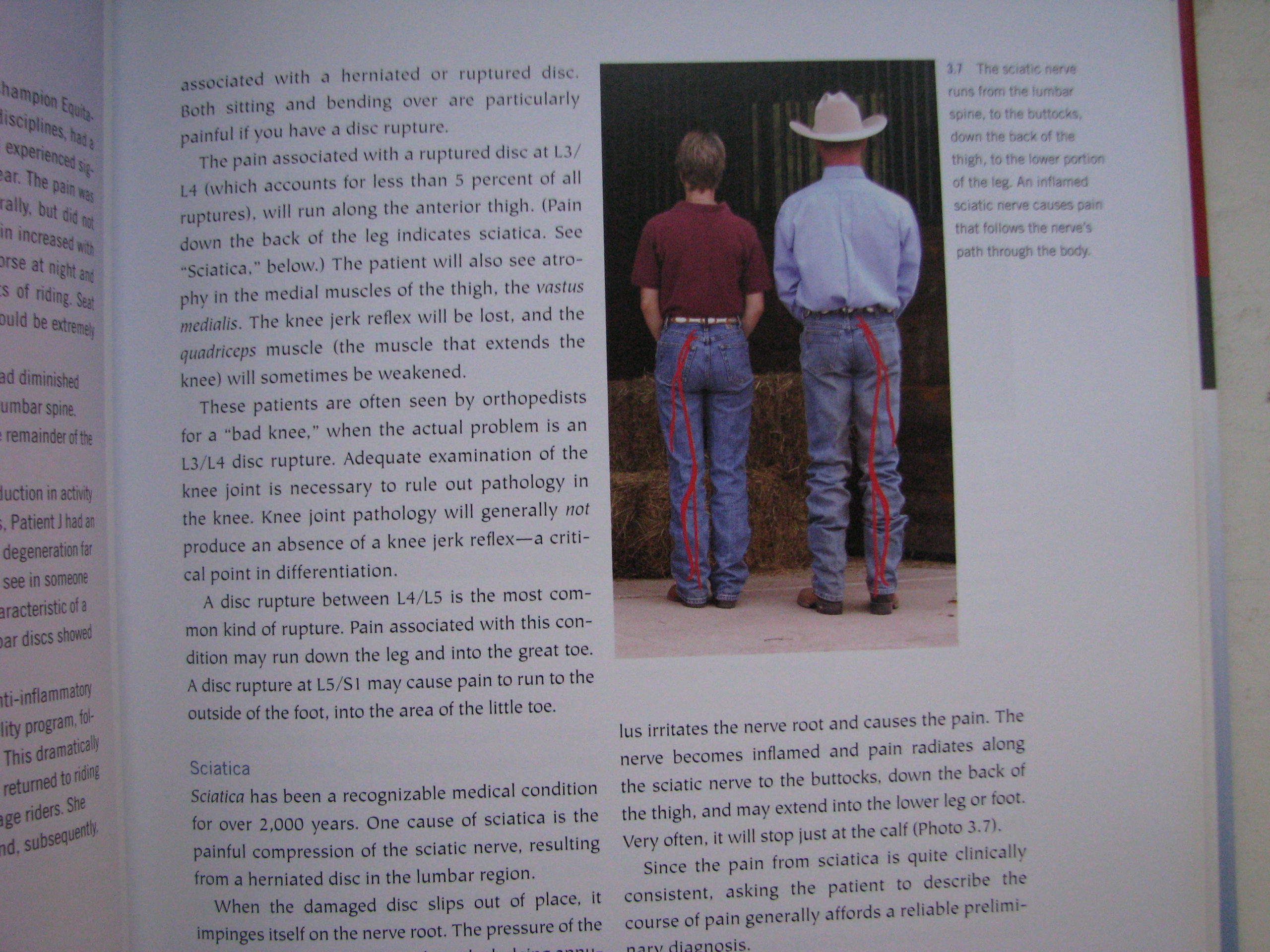 James Warren Riders The Riders Pain Free Back James Warson M.D. - Horse Books